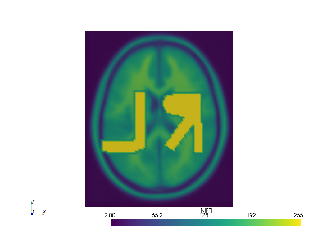 ../../../_images/pyvista-examples-downloads-download_brain_atlas_with_sides-1_00_00.png